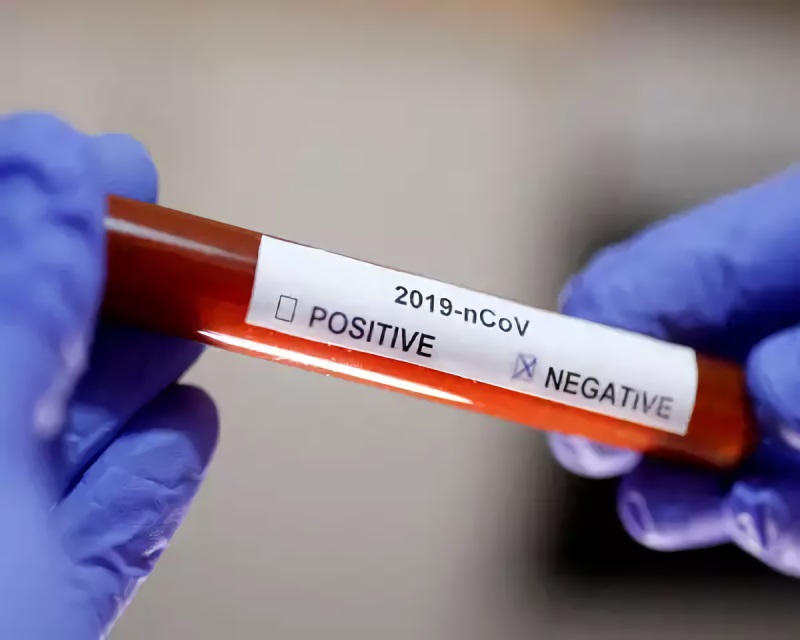 coronavirus test negative