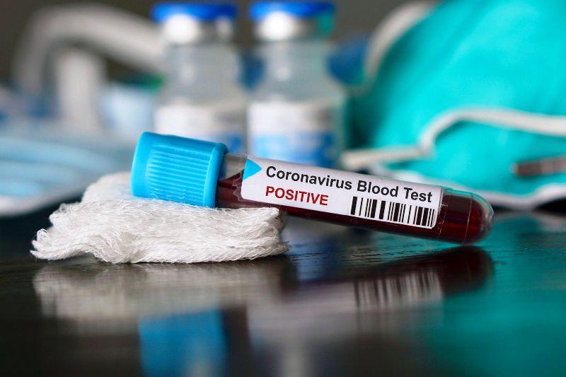 coronavirus blood test positive